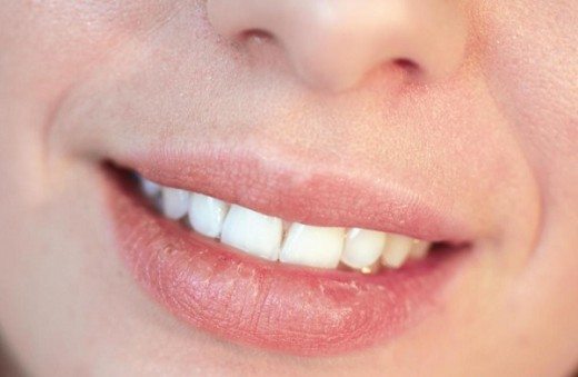 15 mejores remedios caseros para la seca y los labios agrietados