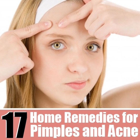 17 simples remedios caseros para las espinillas / acné