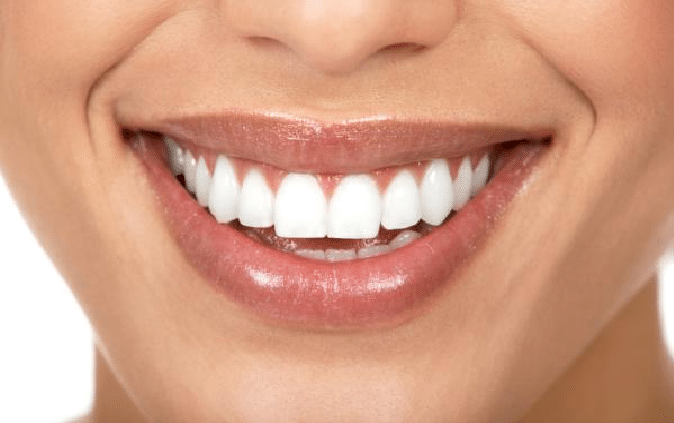 29 Remedios caseros para blanquear los dientes