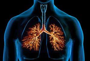 9 Remedios caseros para la bronquitis