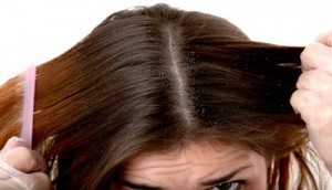 Cómo deshacerse de el cuero cabelludo seco con remedios caseros