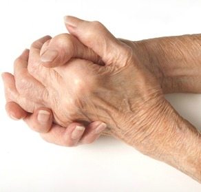 Los tratamientos de la artritis ... Potentes Remedios caseros para la artritis -