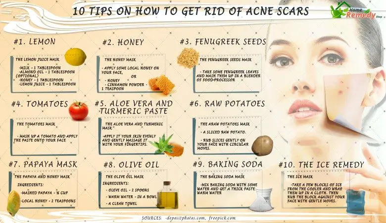 10 Consejos sobre cómo deshacerse de las cicatrices del acné