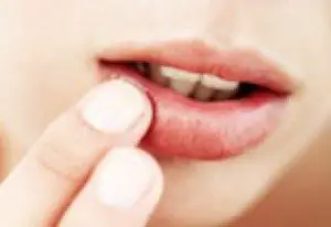 10 Remedios caseros para los labios agrietados