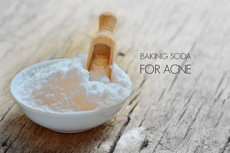 Bicarbonato de sodio para el acné
