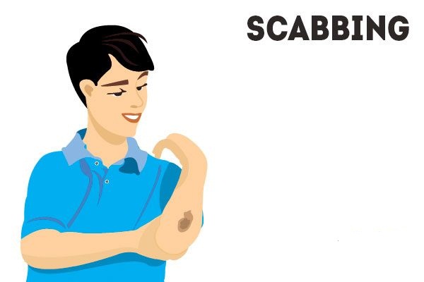 Scabbing