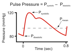 Presión de pulso ensanchada