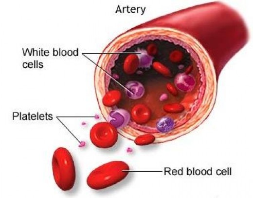Causas bajas del conteo de sangre