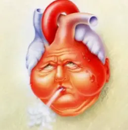Causas de insuficiencia cardíaca congestiva
