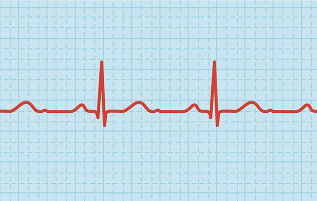Cómo bajar la frecuencia cardíaca