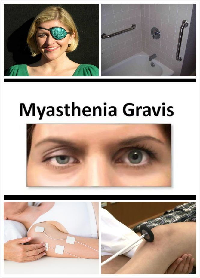 Diagnóstico de Miastenia Gravis