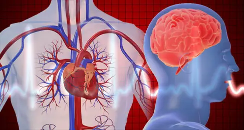 Diferencia entre accidente cerebrovascular y ataque cardíaco