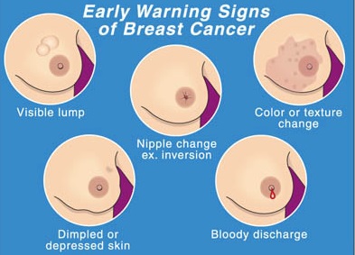 Duele el cáncer de mama