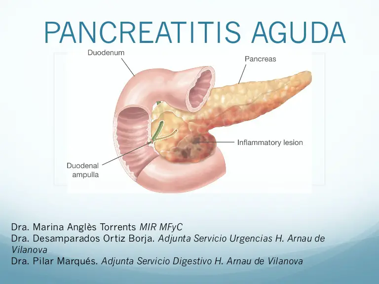 Pancreatitis dieta