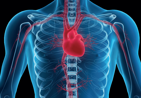 Por qué mueren más personas de enfermedades cardíacas ahora que antes de 1900