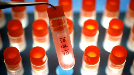 Pros y contras de la investigación con células madre