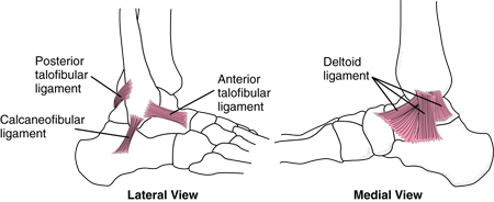 Rotura del ligamento deltoides