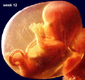 12 semanas de ultrasonido embarazada