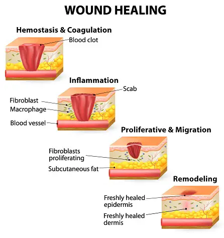 Proceso de cicatrización de heridas