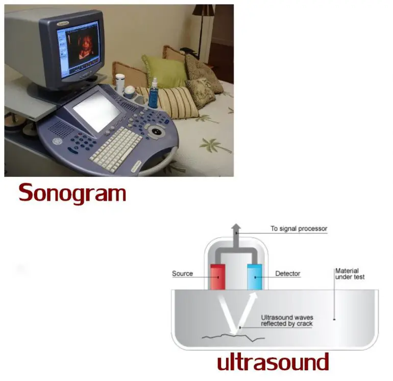 Ultrasonido vs. Sonograma