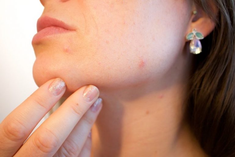 por qué ocurre la alergia en la piel