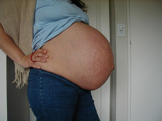 35 semanas de embarazo con gemelos