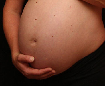 lunares durante el embarazo
